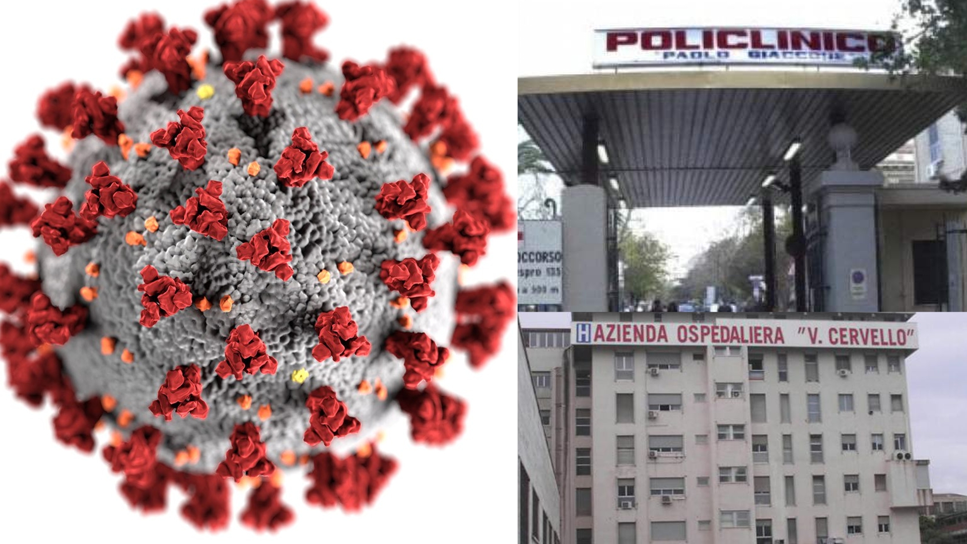 ospedali palermo covid policlinico cervello