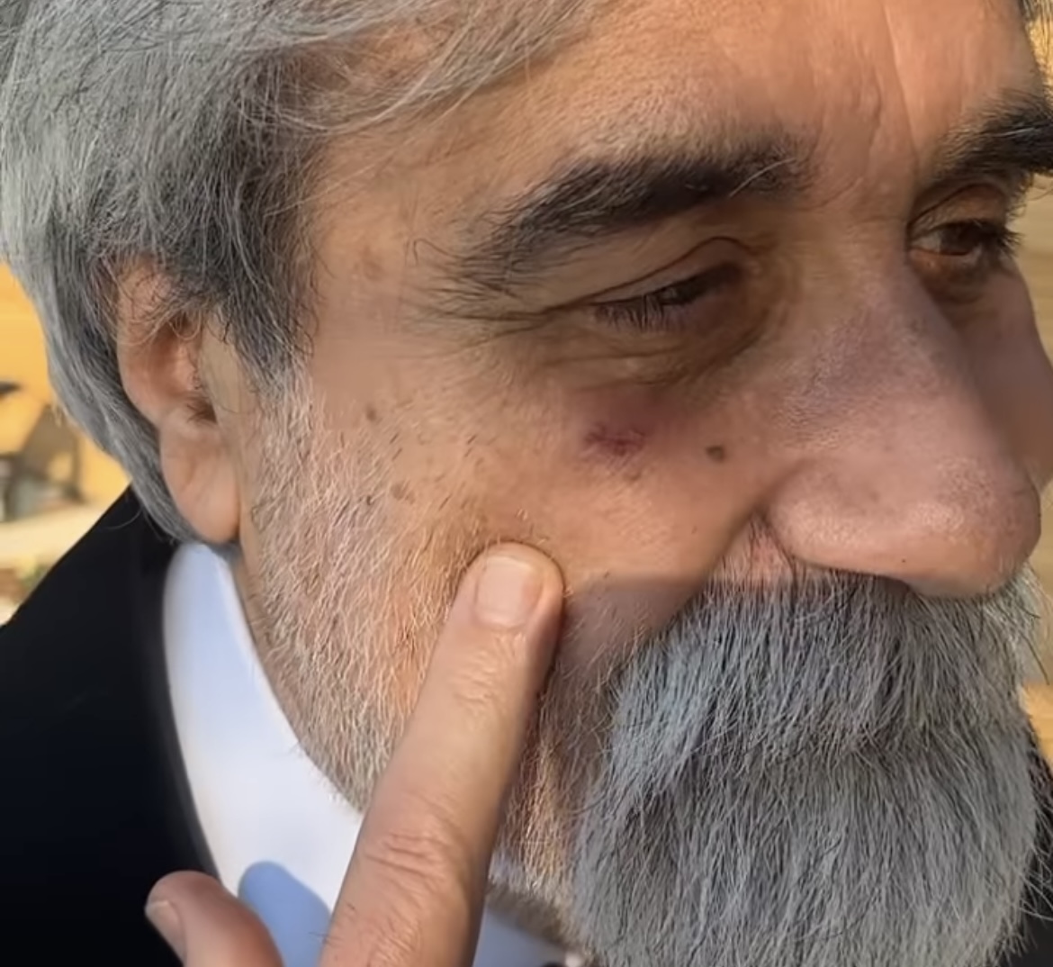 0E7F8F4C-C57D-4593-8373-263A8AF35CBB