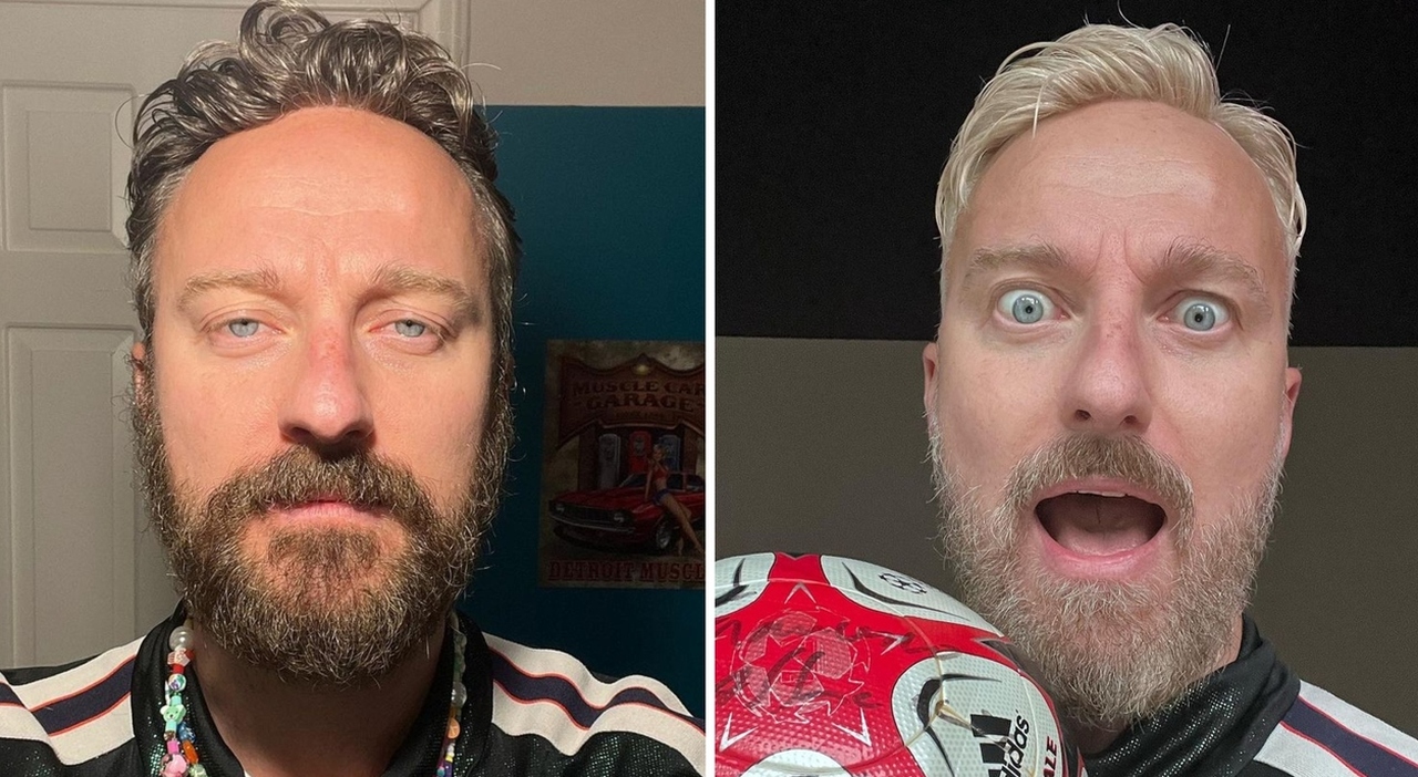 7712963_24145745_francesco_facchinetti_nuovo_look_ken_barbie_oggi_24_10_2023